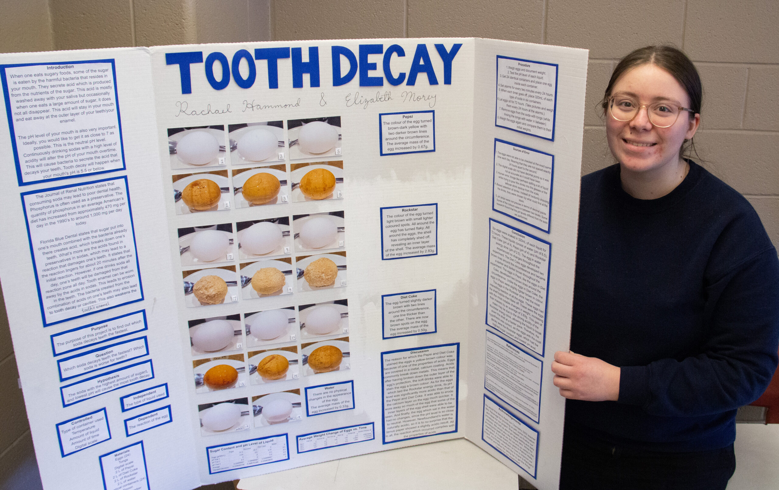 Rachael Hammond stands holding a poster board filled with text and photos of her project titled "tooth decay"